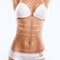 Total Body Lift: Enhance Your Appearance with Safe and Effective Cosmetic Surgery