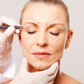 Why should cosmetic surgery be banned?