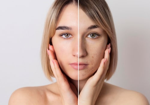 What is the difference between cosmetic surgery and plastic surgery?