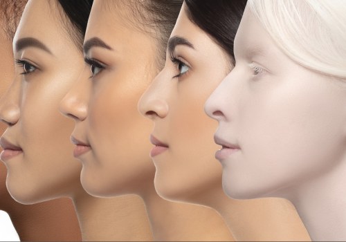 Understanding Rhinoplasty for Functional Purposes