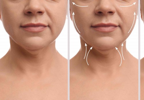 How to Get a Youthful Look with a Neck Lift