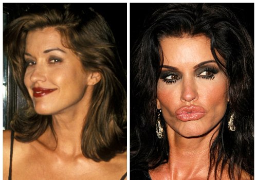 What is bad about cosmetic surgery?