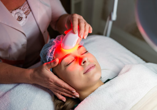 All You Need to Know About Intense Pulsed Light (IPL)