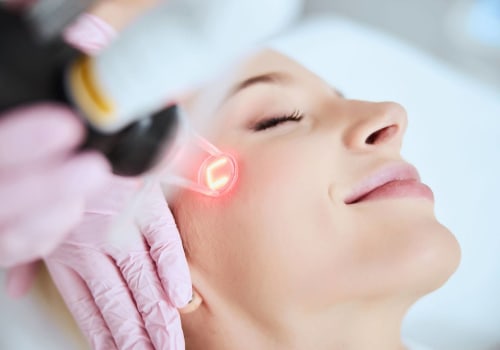 All You Need to Know About Laser Skin Resurfacing