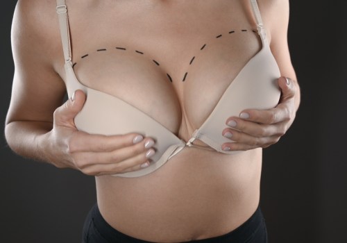 The Basics of Breast Augmentation: A Guide to Enhancing Your Appearance